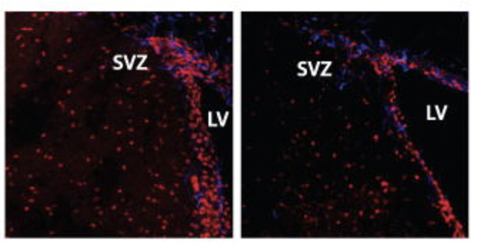 microscopy image of neural stem cells