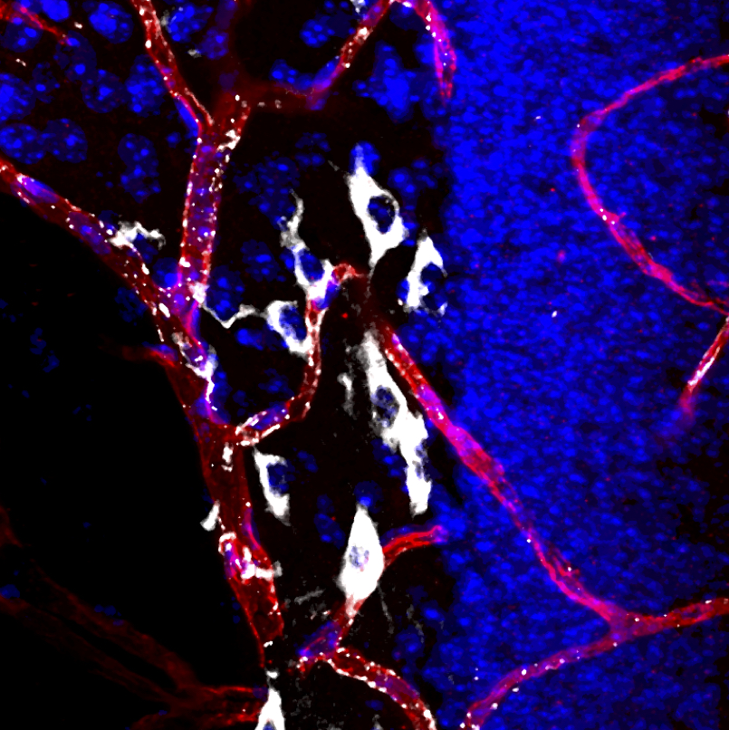Aging blood brain barrier
