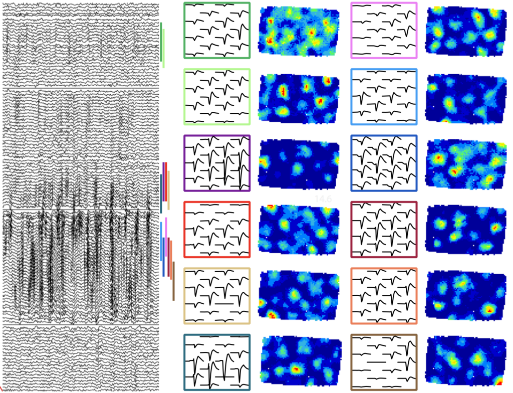 Left: Neural activity recorded from different electrodes within the entorhinal cortrex. Right: Activity patterns for 12 different grid cells recorded simultaneously using Neuropixels