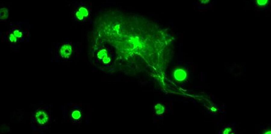 Microscopy image of neutraphil grabbing a pathogen.