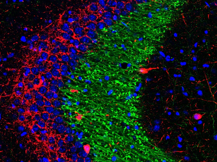 Coronal section of hippocampus