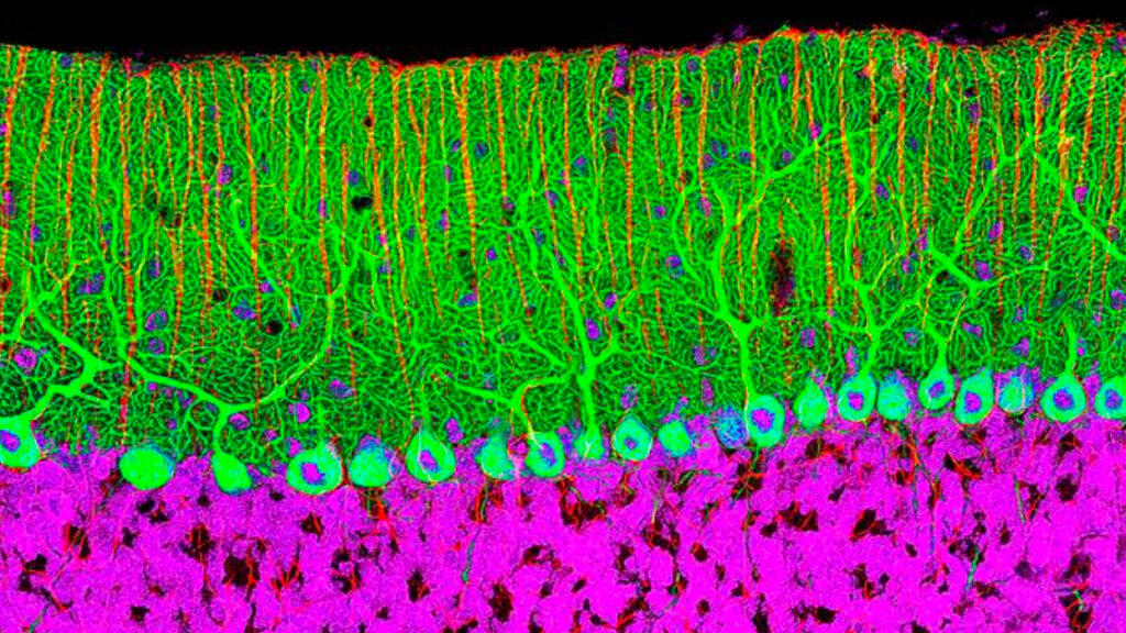 Purkinje Cells cropped image