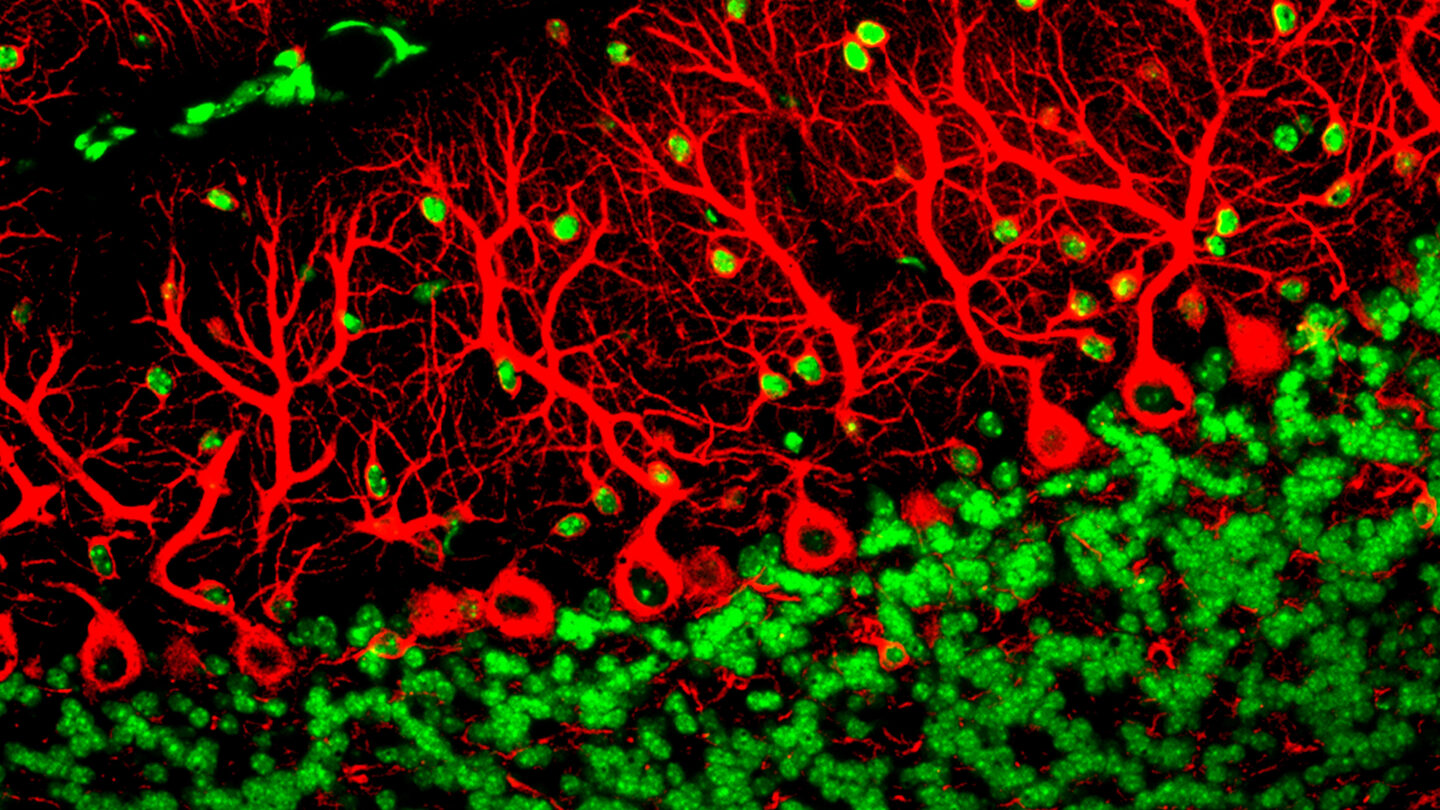 Purkinje cells showing in red