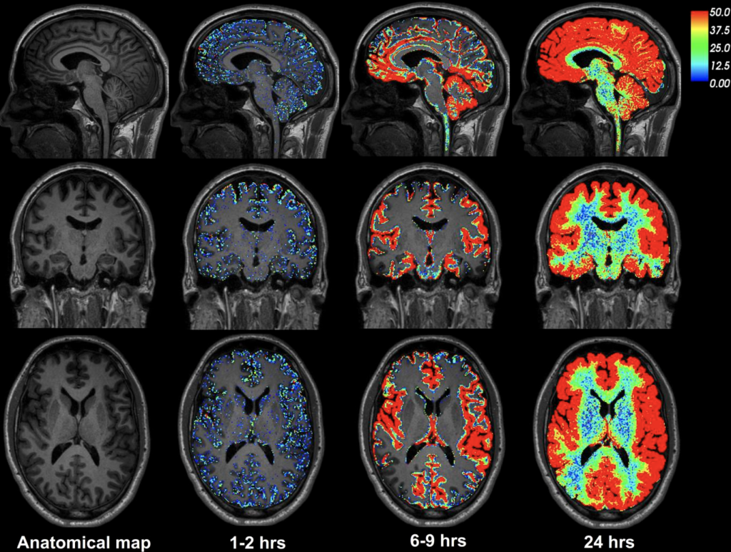 3x4 array of MRI scans (12 total)