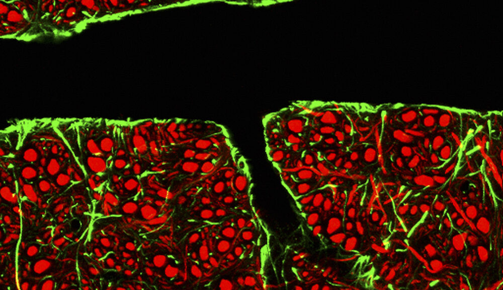 Glial cells, which surround the blood vessels, are shown in green. Neurons are shown in red