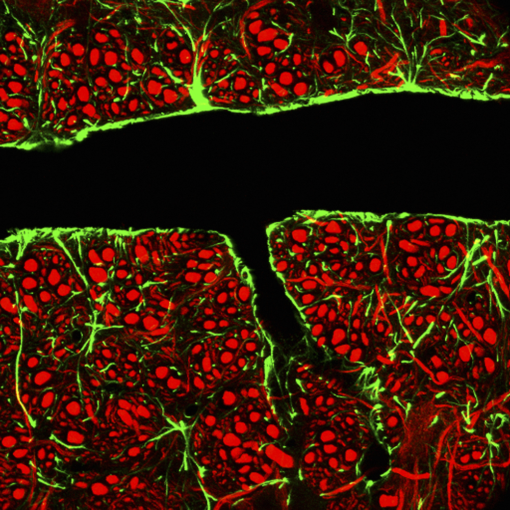 Glial cells, which surround the blood vessels, are shown in green. Neurons are shown in red