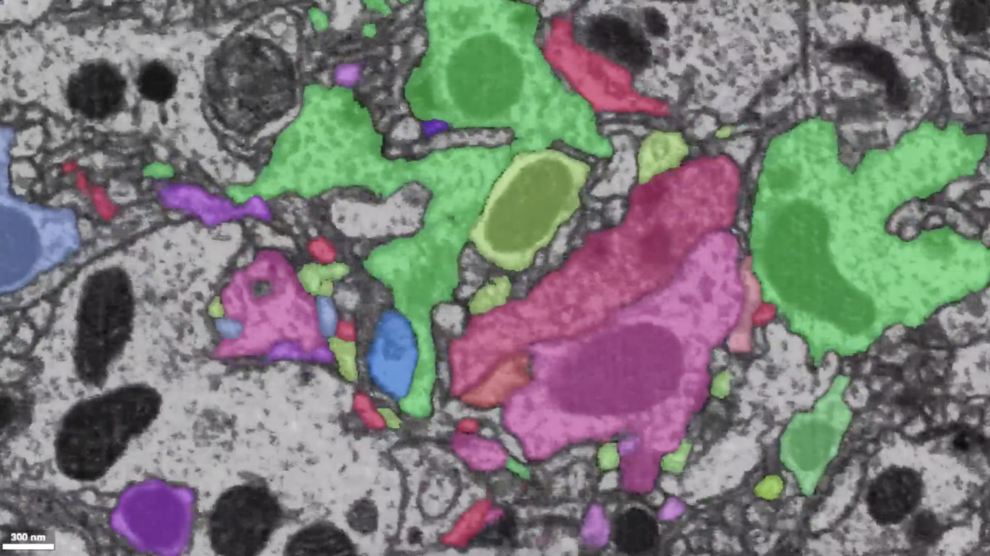 A detailed map of every neuron and neuronal connection in the brain made with machine learning algorithms.
