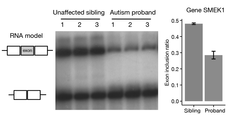 Image shows a gel with RNA bands for sibling and proband, labeled 1-3 each. Right: bar graph shows higher exon inclusion ratio in sibling versus autism proband for gene SMEK1, with error bars indicated.