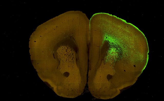 Projections from the ventromedial thalamus to the frontal cortex highlighted in green