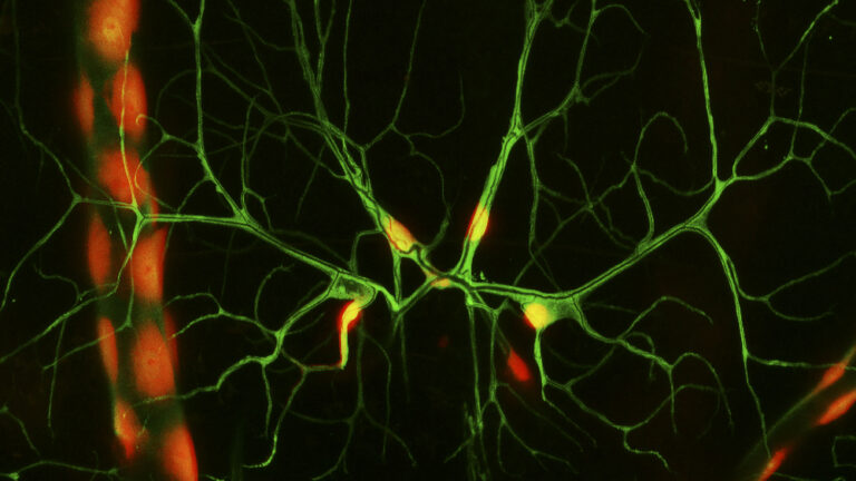 Microscopic image showing green fluorescent nerve cells with branching dendrites and a few red-orange highlights on a dark background.
