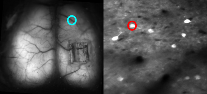 Side-by-side black and white brain images; left shows a brain surface with veins and a small rectangle, blue circle highlights an area; right shows scattered white spots, red circle highlights one spot.