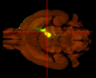 Top view of a brown brain scan with a bright green glowing spot at the center. Two red lines intersect at the glowing area, forming a crosshair on the image. Black background.