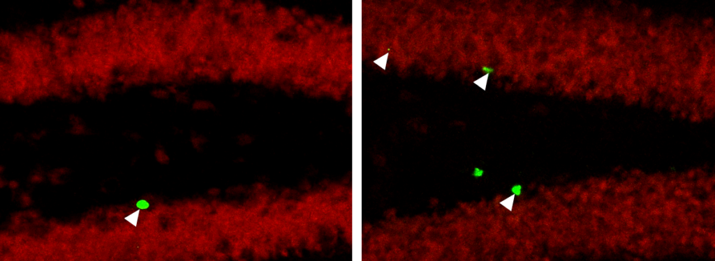 Old mice injected with a protein associated with exercise (right) begin producing more new neurons (green) in the hippocampus than control mice (left), suggesting this treatment mimics the beneficial cognitive effects of exercise