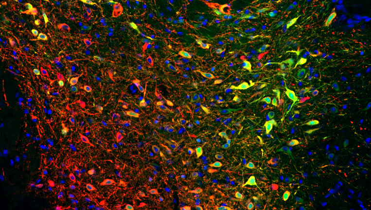Some dopamine neurons (red) in the ventral tegmental area respond to reward, others to the animal’s position, speed or acceleration. Calcium activity, a proxy for neural activity, is highlighted in green.