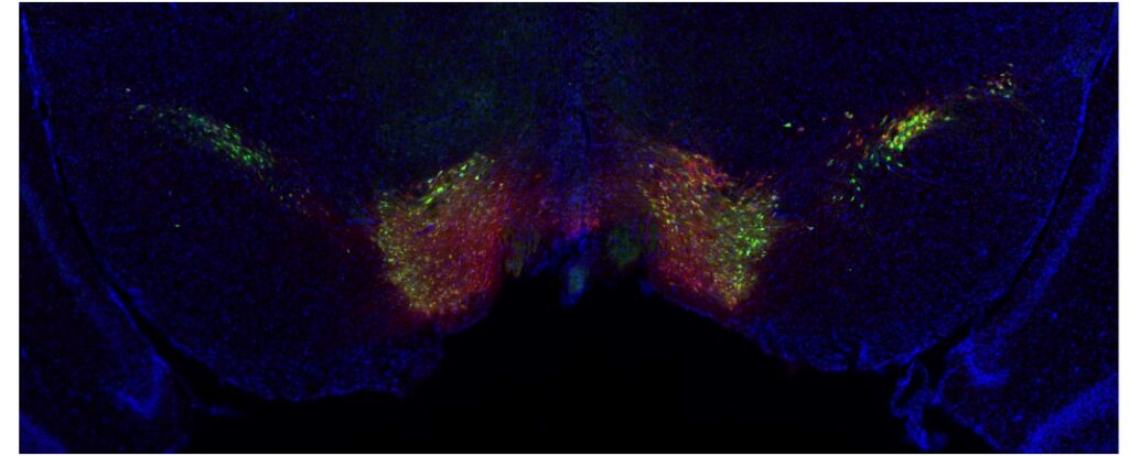 Fluorescence microscopy image of a brain section showing red, green, and yellow neural activity patterns in symmetrical clusters on a dark blue background.