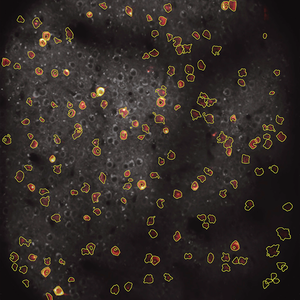 Microscope image of cells with highlighted edges and colored outlines, scattered across a dark background. Some cells are clustered, while others are isolated.