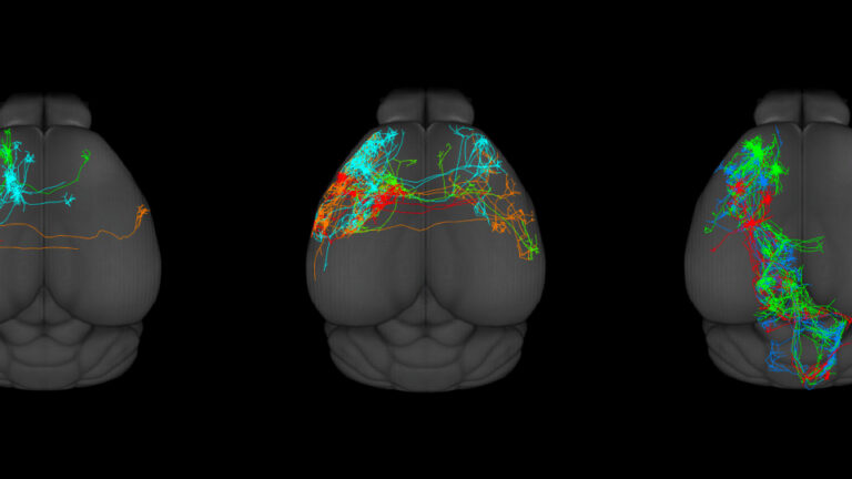 Five brain models in a row show colorful neural pathways—red, green, blue, orange, and yellow—mapped across different regions, highlighting brain connectivity against a black background.
