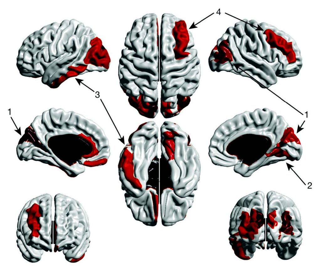 Images of growing brains and active regions