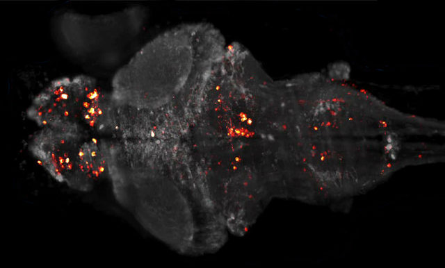 Calcium Imaging of zebrafish