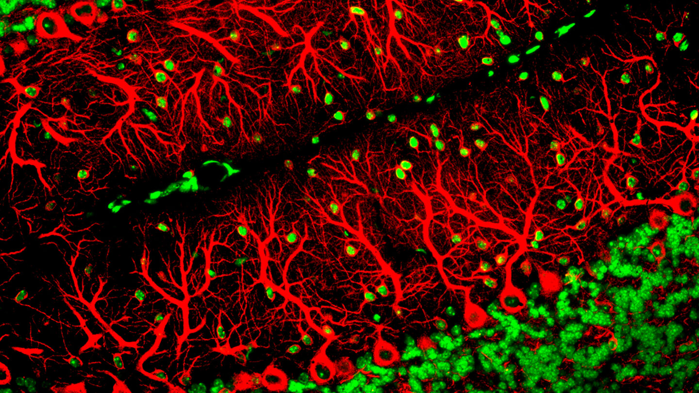 Purkinje cells showing in red