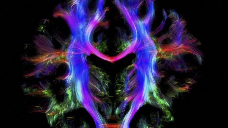 Neon colored wiring in the human brain