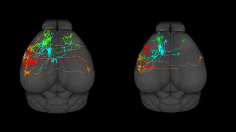 brain with rainbow imaging