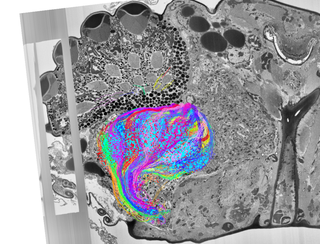 Black and white microscopic tissue image with a colorful, swirling neural network pattern overlayed in the center; pattern features vivid lines in blue, pink, and orange tones.