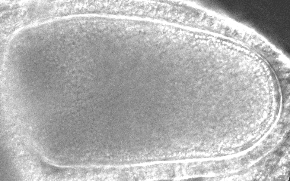 Microscopic image showing a close-up view of an oval-shaped cell with defined outer and inner boundaries, displaying a grainy texture inside the cell.