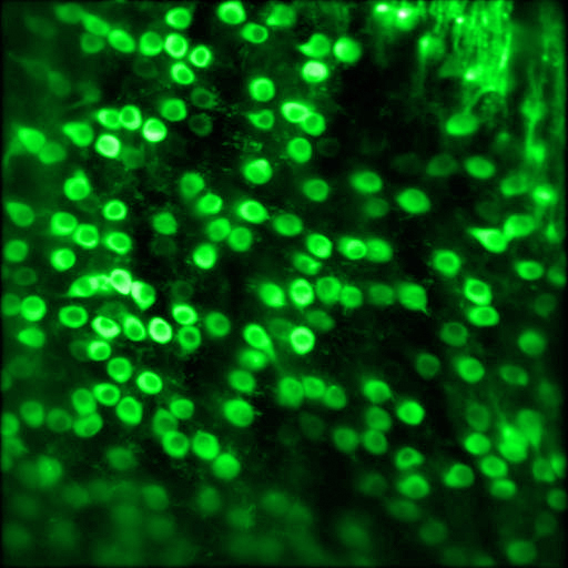 Green-tinted image of how researchers recorded activity from Purkinje cells in the cerebellum