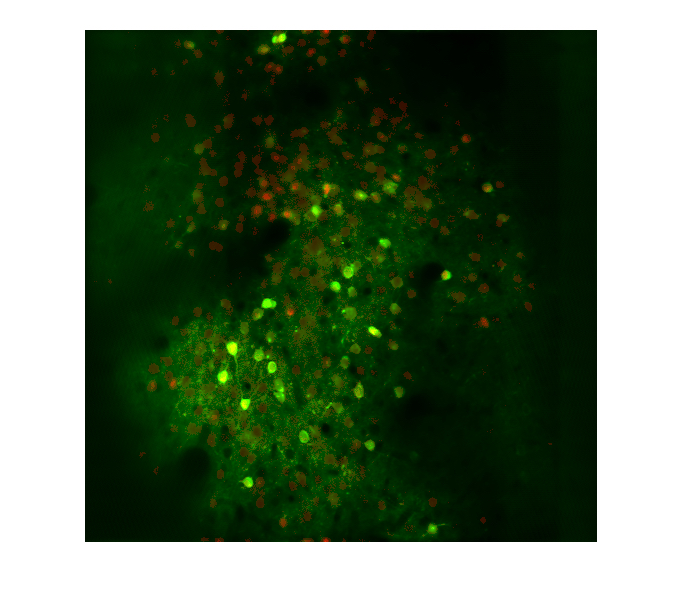A slice of mouse cortex in which cells are tagged with GCaMP (green), a marker of neural activity, and ChroME (red), a fast-acting opsin that can activate neurons with high temporal precision