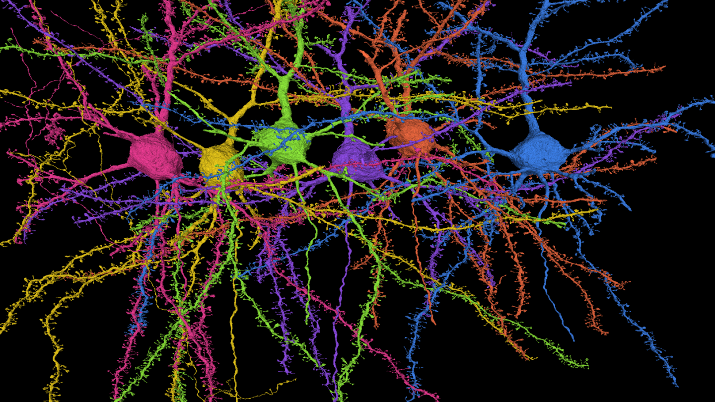 Pink, yellow, green, purple, orange and blue neurons