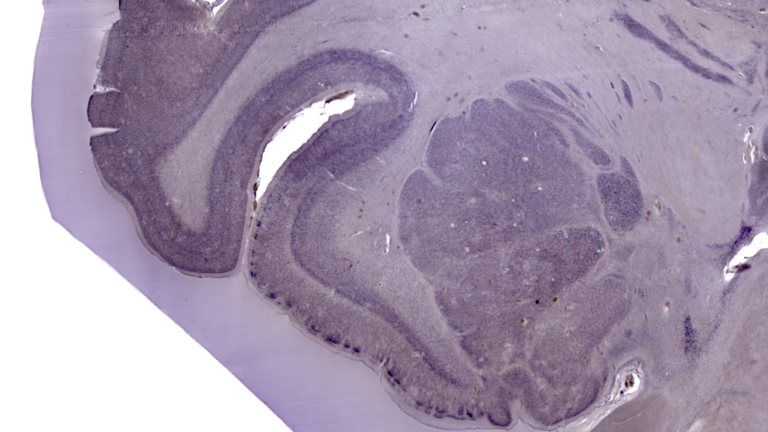 Microscopic image of a brain tissue section stained in shades of purple, showing layered and folded structures with distinct regions and cell patterns.