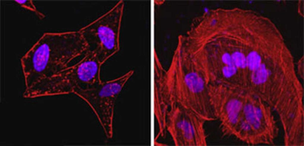 Two microscope images show cells with blue-stained nuclei and red-stained cytoskeletons, highlighting cell structure differences. The left image shows elongated cells; the right image shows rounder, more clustered cells.