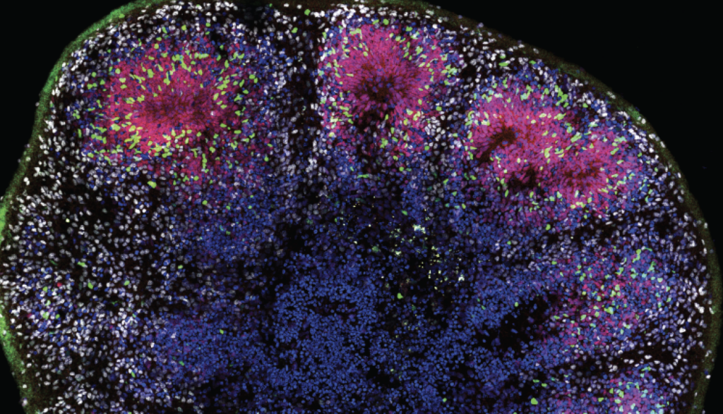 Image of brain with neurons firing