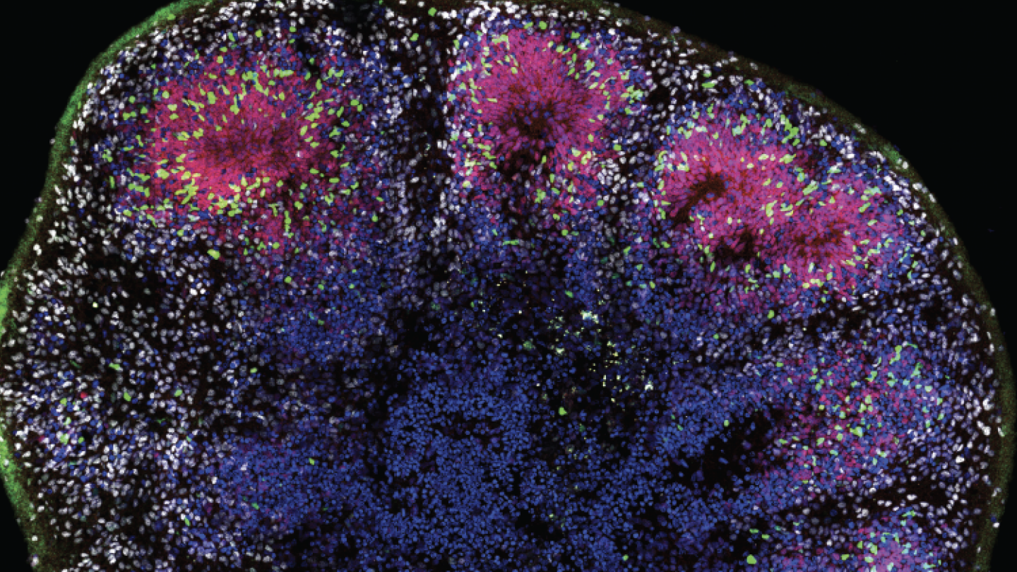 Image of brain with neurons firing
