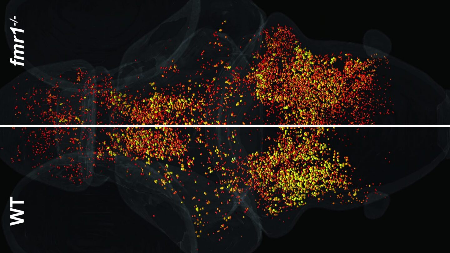 Image of neurons in brain