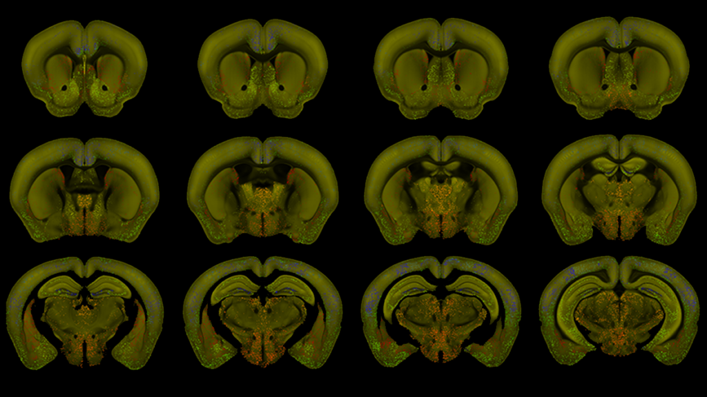 Twelve coronal brain slice images arranged in a 3x4 grid on a black background, showing anatomical structures in different shades of green and yellow.