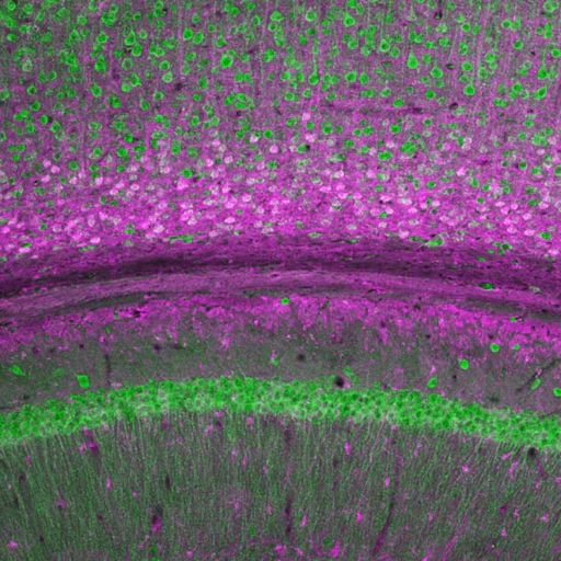 Fluorescent microscopy image of brain tissue, showing green and magenta stained cells and layers, highlighting structural differences and cellular distribution in the sample.