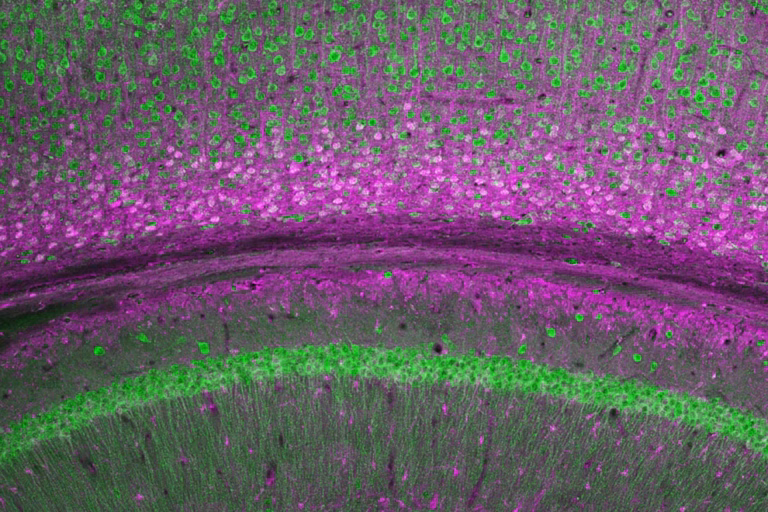 Fluorescent microscopy image of brain tissue, showing green and magenta stained cells and layers, highlighting structural differences and cellular distribution in the sample.