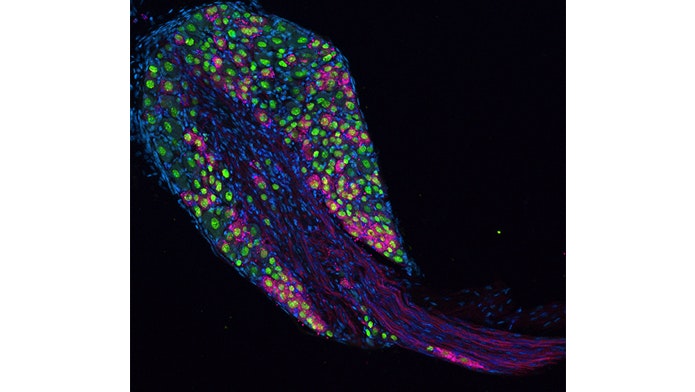 Microscopic image of a tissue sample with green, blue, and red fluorescent staining highlighting cells, nuclei, and fibers against a black background.