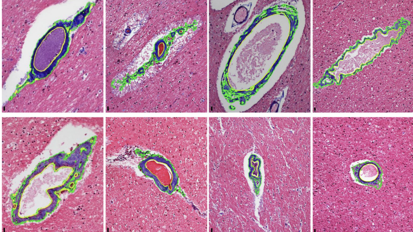 Image of brain material
