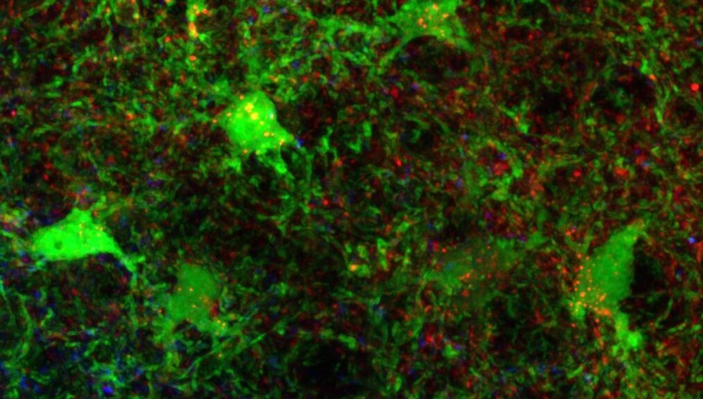 Fluorescent microscopy image showing glowing green cells with red and blue specks on a dark, textured background, highlighting cellular structures and neural activity.