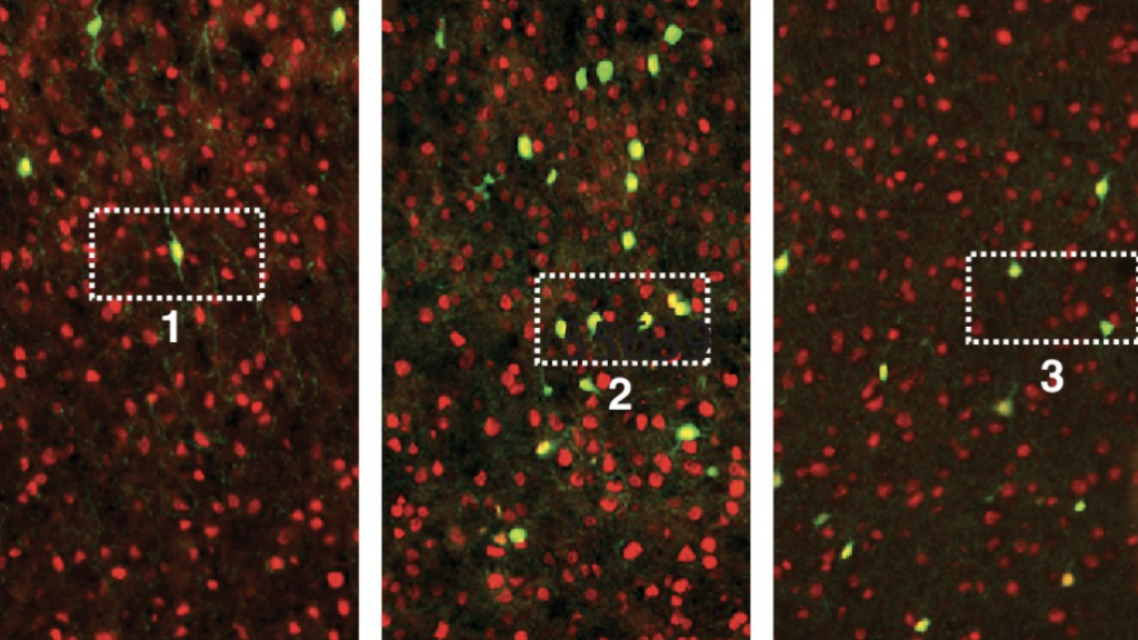 Image of neurons