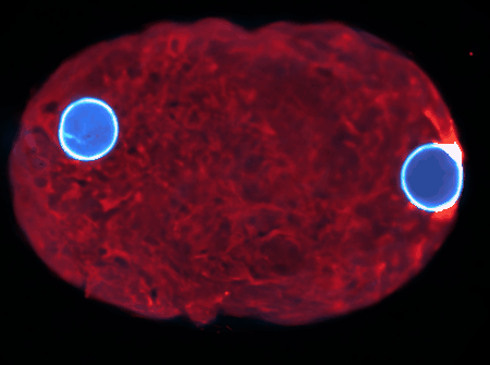 Fluorescent microscope image of a cell with two bright blue circular structures on each side, surrounded by a red, textured background, set against a black backdrop.