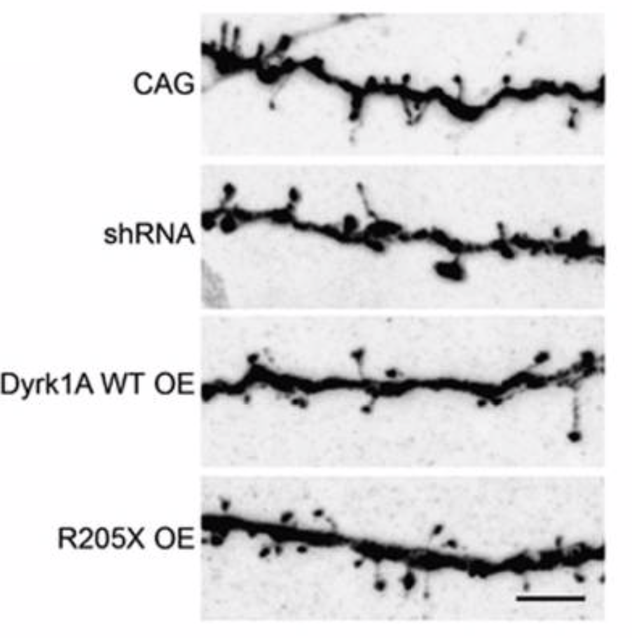 Four black and white microscope images show dendritic spines on neuron branches, labeled: CAG, shRNA, Dyrk1A WT OE, and R205X OE. Each row displays variations in spine density and structure.