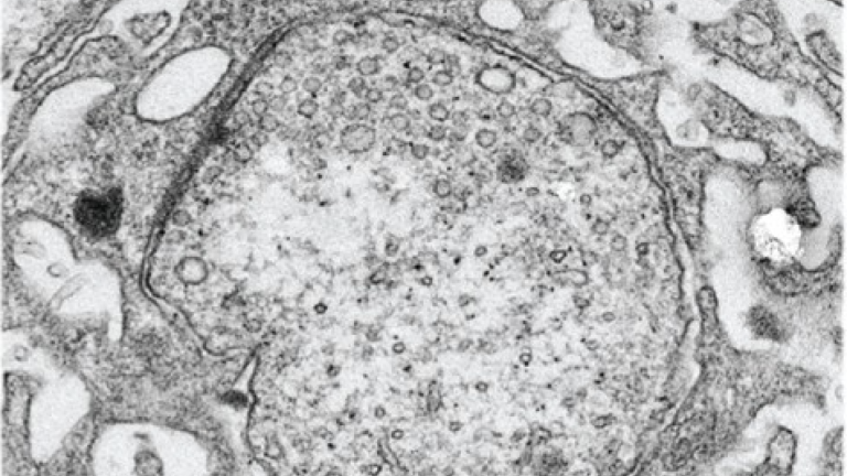 Image of brain tissue