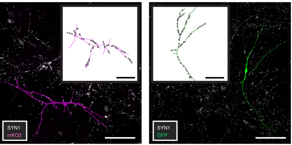 Image of Connectivity comparisons of neurons.