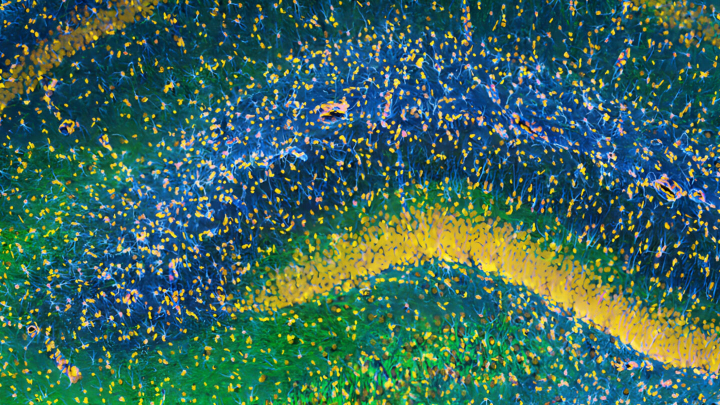 Image of the hippocampus was taken with an ultra-widefield high-speed multiphoton laser microscope.