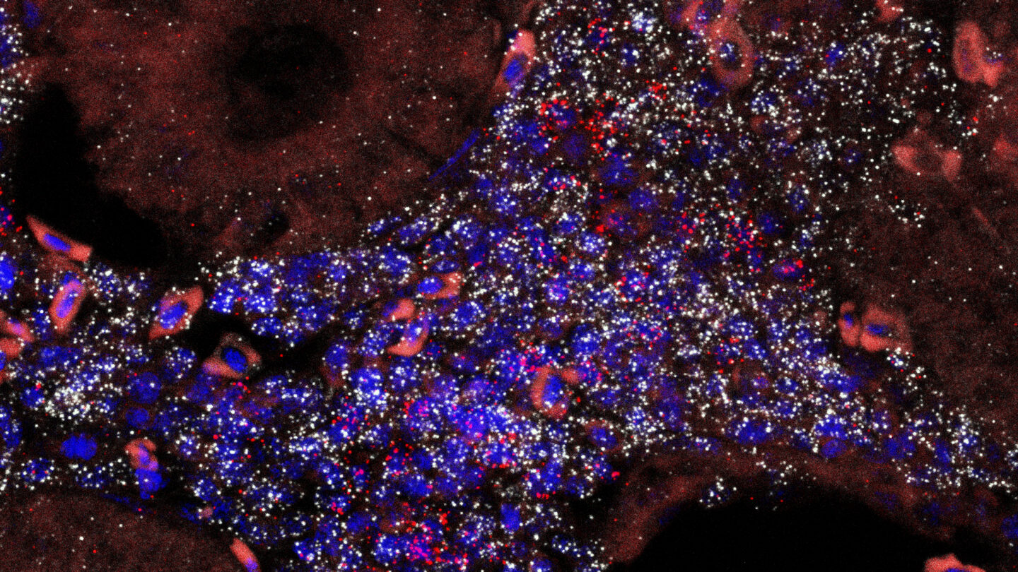 An epifluorescence image of a young male killifish kidney tissue showing the organization of the renal tubules.