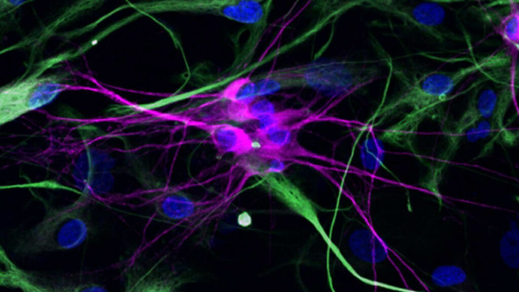 Photo of nerve cells in petri dishes. Neural wires have grown from the cells as they try to connect.